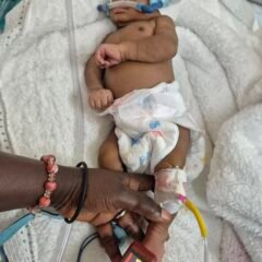 Percées en néonatologie : la respiration continue CPAP au Centre Hospitalier Chiara Lubich